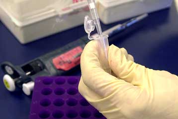 Γενετικό τεστ θα προβλέπει περιστατικά καρκίνου του προστάτη