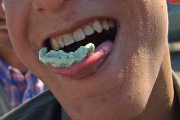 Πειραματική τσίχλα προστατεύει από τον καρκίνο του στόματος