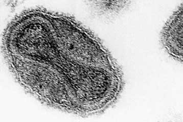 Ο ΟΗΕ ανέβαλε την απόφαση για καταστροφή των τελευταίων δειγμάτων ευλογιάς