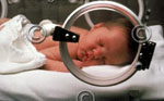 Τα πρόωρα νεογνά κινδυνεύουν να εξελιχθούν σε υπερκινητικά παιδιά