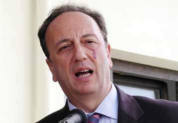 Αδικες χαρακτηρίζει τις κινητοποιήσεις στα πανεπιστήμια ο Γ.Καλός