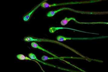 Γενετικές βλάβες συσσωρεύει το σπέρμα με το πέρασμα του χρόνου