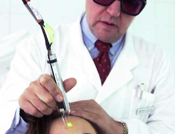 Πρωτοποριακό λέιζερ λιώνει το λίπος και καταπολεμά κυτταρίτιδα και ακμή