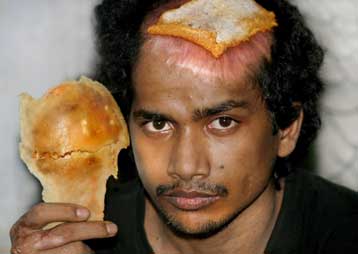 Κοσμοσυρροή για νεαρό Ινδό που κρατάει κομμάτι του κρανίου του