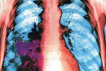 Κακά νέα, καλά νέα για τις γυναίκες καπνίστριες