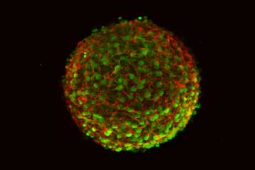 «Ναι» της Γερουσίας, «όχι» του Μπους στις έρευνες με ανθρώπινα έμβρυα