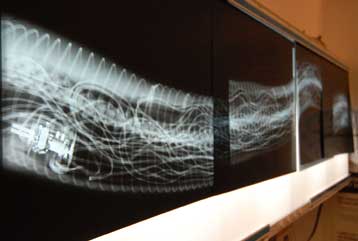 Κατοικίδιος πύθωνας κατάπιε ηλεκτρική κουβέρτα