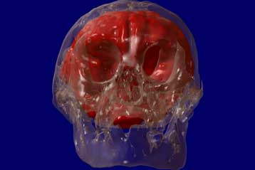 Ο «Χόμπιτ» της Ινδονησίας ίσως δεν ήταν διαφορετικό είδος ανθρώπου