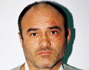 Υπό δρακόντεια μέτρα ασφαλείας νοσηλεύεται ο Νίκος Παλαιοκώστας