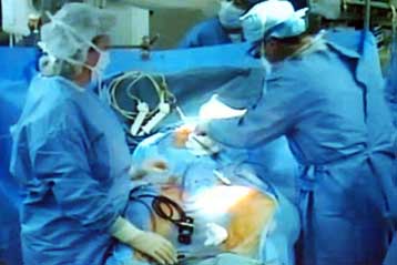 Νέας γενιάς στεντ που κρατούν τις αρτηρίες ανοιχτές για πολλά χρόνια