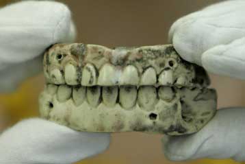 Μασέλα 200 ετών εκτίθεται σε βρετανικό μουσείο