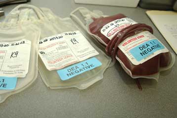 Ακόμα μια περίπτωση μετάδοσης του HIV από μετάγγιση