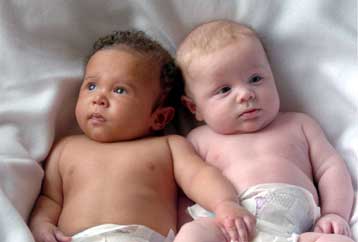Σπάνια δίδυμα διαφέρουν ακόμα και στο… χρώμα