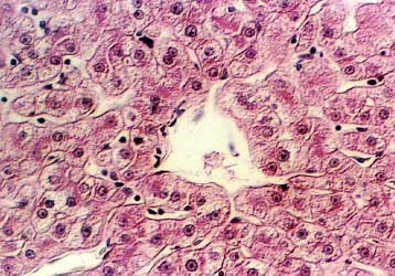 Μίνι ανθρώπινο συκώτι καλλιεργήθηκε στο εργαστήριο