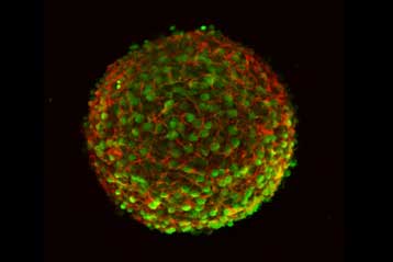 Εμβόλιο με βλαστικά κύτταρα προστατεύει από τον καρκίνο του πνεύμονα