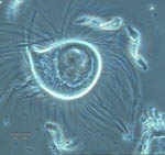 Η εντερική οικολογία καθορίζει την προδιάθεση στην παχυσαρκία