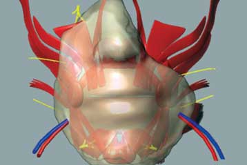 Δεύτερη επέμβαση μερικής μεταμόσχευσης προσώπου στη Γαλλία