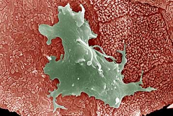 Εκπλήξεις έκρυβε το γονιδίωμα της ενοχλητικής τριχομονάδας