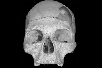 Αρχαίο κρανίο «δείχνει επιμειξία των σύγχρονων ανθρώπων με τους Νεάντερταλ»