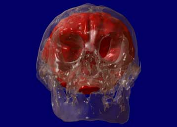 Η γυναίκα Χόμπιτ «ήταν πράγματι άλλο είδος ανθρώπου»