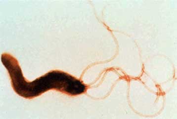 Το βακτήριο του έλκους ακολουθεί τον άνθρωπο εδώ και 60.000 χρόνια