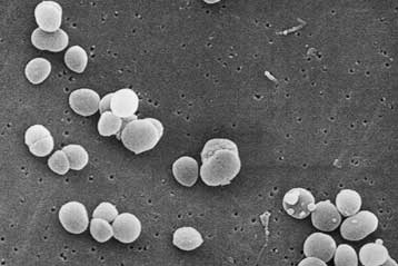 Τα μικρόβια του σώματος περισσότερα από τα ανθρώπινα κύτταρα