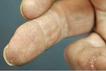 Νέες τεχνολογίες υπόσχονται ανάπλαση χαμένων δοντιών και δακτύλων