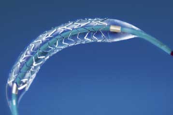 Οι περισσότερες επεμβάσεις αγγειοπλαστικής «είναι περιττές»