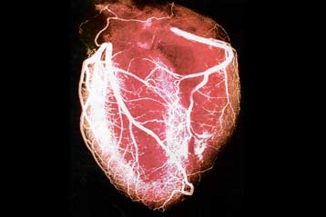 Αντικατάσταση της αορτικής βαλβίδας τώρα και με τοπική αναισθησία