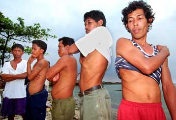 Το παράνομο εμπόριο οργάνων υπονομεύει τα προγράμματα δωρητών