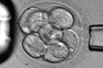 Η αμερικανική Γερουσία υπέρ της έρευνας με εμβρυικά κύτταρα