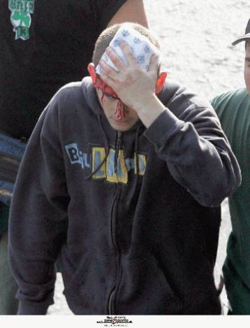 Ένας 27χρονος ομολόγησε ότι συμμετείχε στη δολοφονία Φιλόπουλου