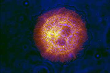 Μικροσκοπική συσκευή ζυγίζει μεμονωμένα κύτταρα