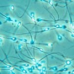 Ο διαβήτης επηρεάζει αρνητικά την ανδρική γονιμότητα