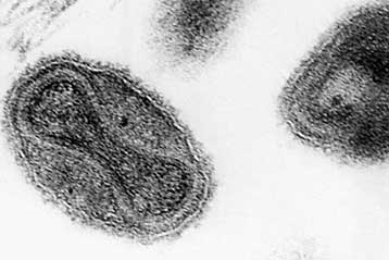 Αναβλήθηκε εκ νέου η καταστροφή των τελευταίων δειγμάτων ευλογιάς