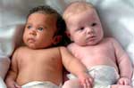 Μειωμένη γονιμότητα για τα κορίτσια που έχουν δίδυμο αδερφό