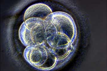 Νέο βέτο Μπους στην έρευνα με ανθρώπινα έμβρυα