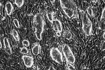 Νέα μέθοδος παραγωγής βλαστοκυττάρων παρακάμπτει τα ηθικά διλήμματα