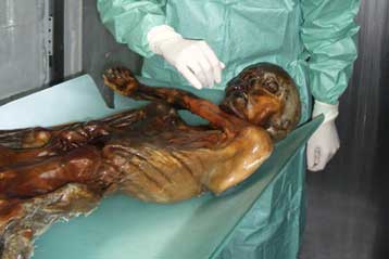 Θύμα δολοφονίας είχε πέσει ο Ότζι, η παγωμένη μούμια των Αλπεων