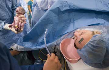 Δύο σετ εξάδυμων γεννήθηκαν σε διαφορετικές πολιτείες των ΗΠΑ