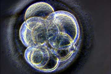 Ο προεμφυτευτικός γενετικός έλεγχος «μειώνει την πιθανότητα επιτυχίας»