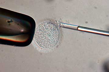 Κορίτσι στον Καναδά θα μπορούσε να γεννήσει τον αδελφό της