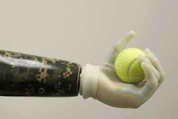 Βιονικό χέρι φτάνει σε νέα επίπεδα ευελιξίας