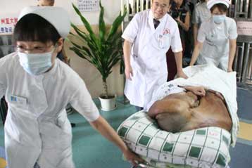 Όγκος 15 κιλών αφαιρέθηκε από το πρόσωπο ασθενή στην Κίνα