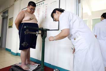 Η παχυσαρκία αποδεικνύεται «κοινωνικά μεταδοτική»