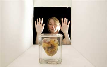 Λήπτρια μοσχεύματος εκθέτει την παλιά καρδιά της