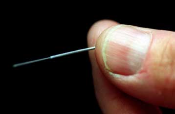 Βελονισμός, «η καλύτερη λύση για τους πόνους στη μέση»