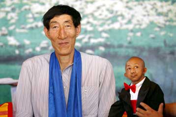 Για περισσότερα προβλήματα υγείας παραπονιούνται οι κοντοί άνθρωποι