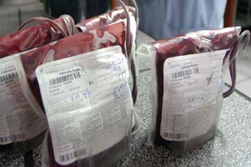 Πολύτιμη ιδιότητα του αίματος χάνεται στις μεταγγίσεις