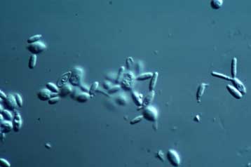 Ολοκληρώθηκε ο γενετικός χάρτης για το μύκητα της πιτυρίδας